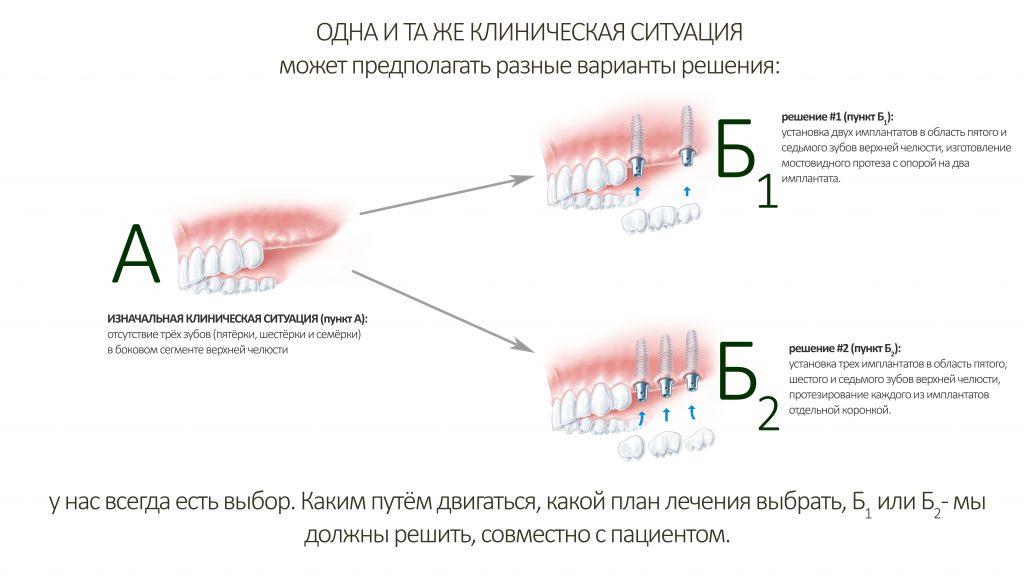 План лечения зубов