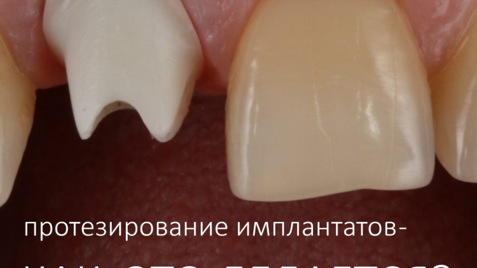 инста2