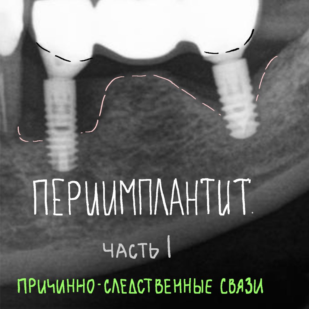 инста