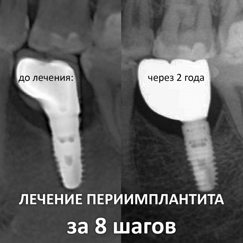 инста1