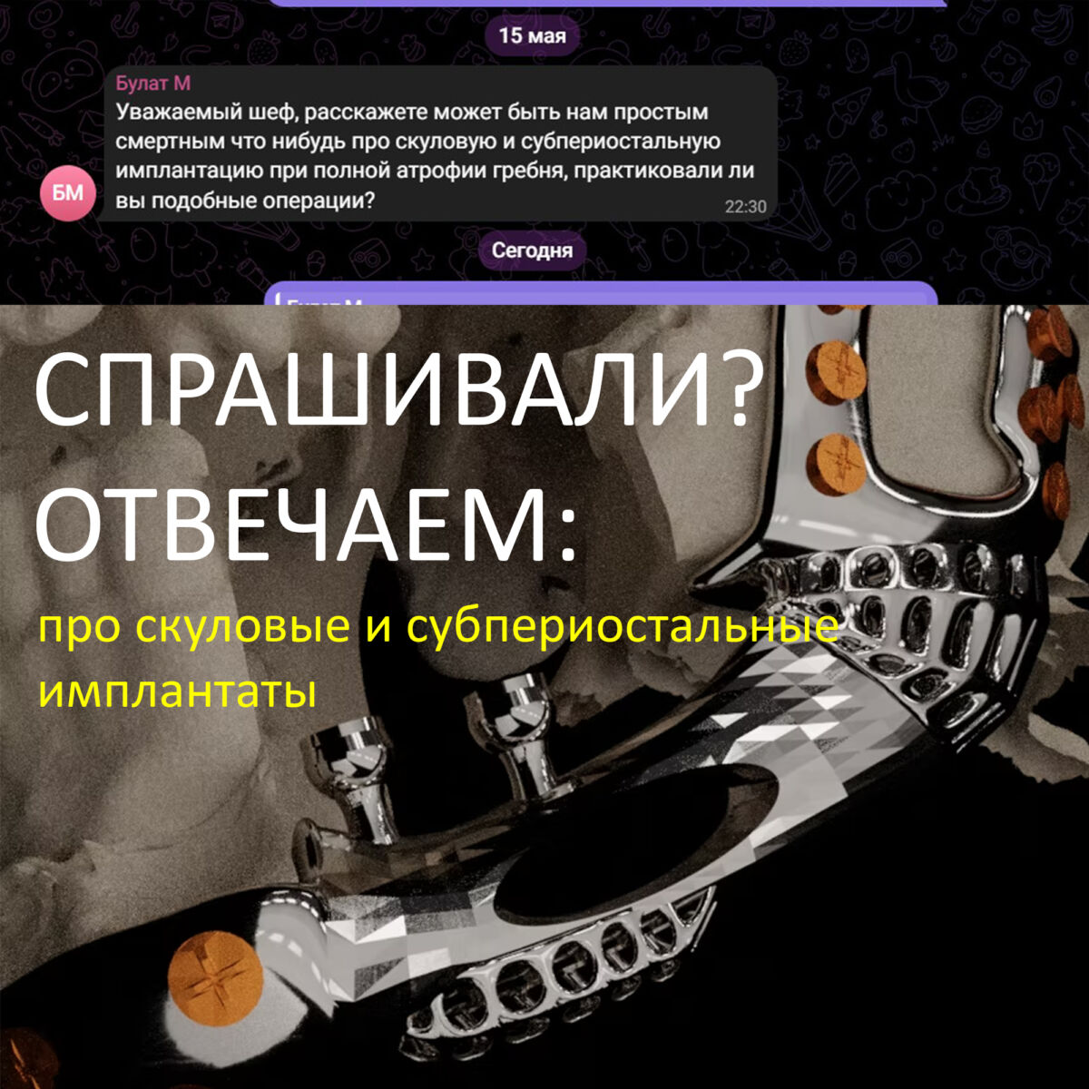 СПРАШИВАЛИ? ОТВЕЧАЕМ! Про скуловые и субпериостальные имплантаты.