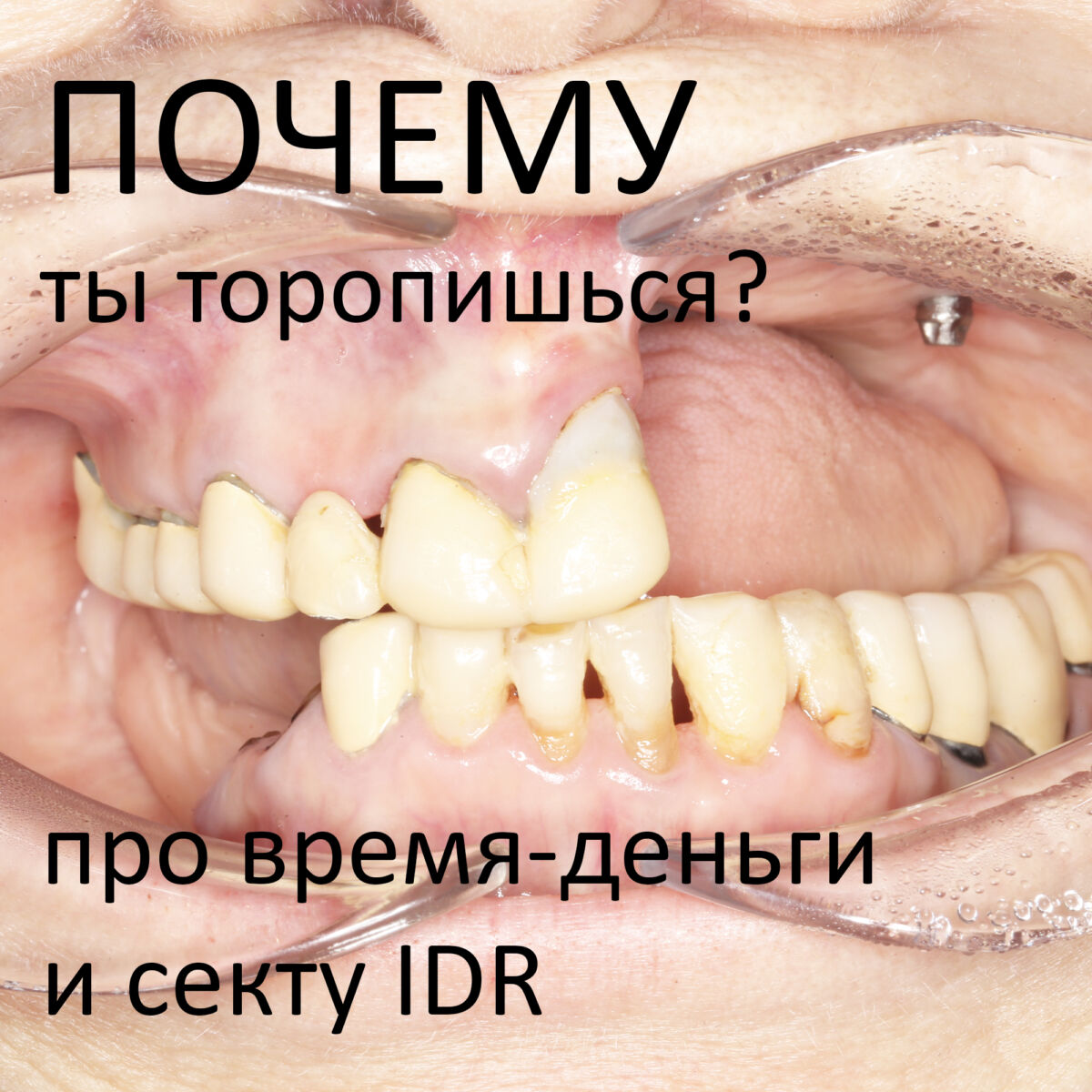 Почему ты торопишься? Про время, деньги и IDR